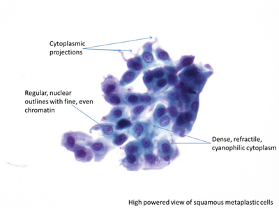 Pap Smear คืออะไร? test สามารถใช