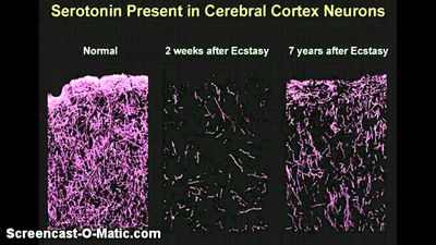 Serotonin และ Seratonin วย เซโรโทน